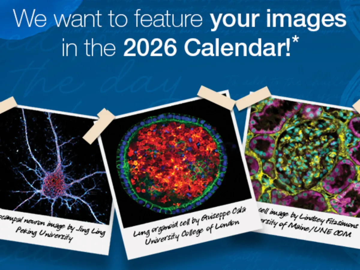 Thermo Fisher Scientific Gibco Calendar — free sample: Get your free 2026 Gibco/Invitrogen calendar from Thermo Fisher Scientific! Fill out the form with y